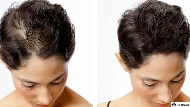 Haar Tattoo für Frauen Endergebnis